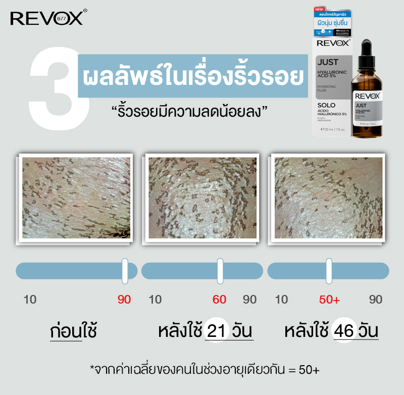 Revox B77 - Skin Test